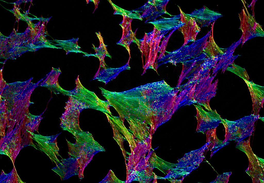 ImageJ=1.52g